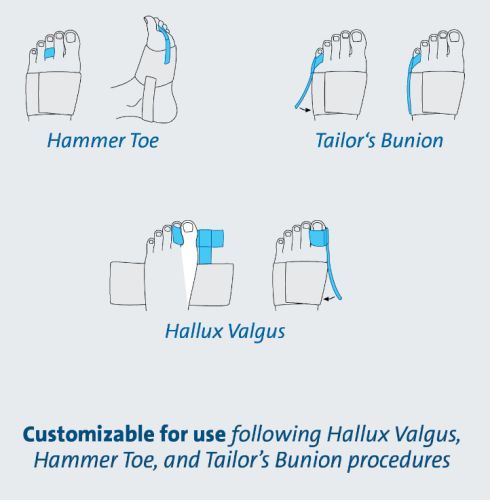 Toe Alignment Splint Darco